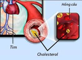 vì sao cần uống thuốc hạ mỡ máu